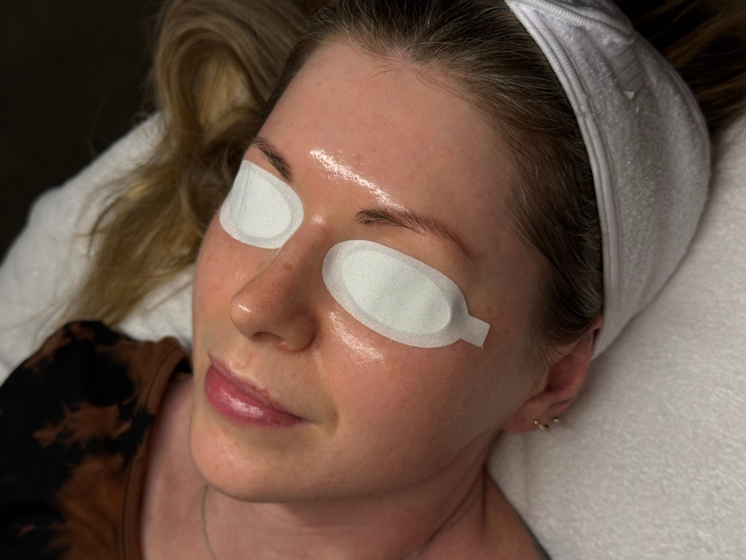 Woman with eye patches lying down, head resting on a pillow, wearing a headband, smiling softly.