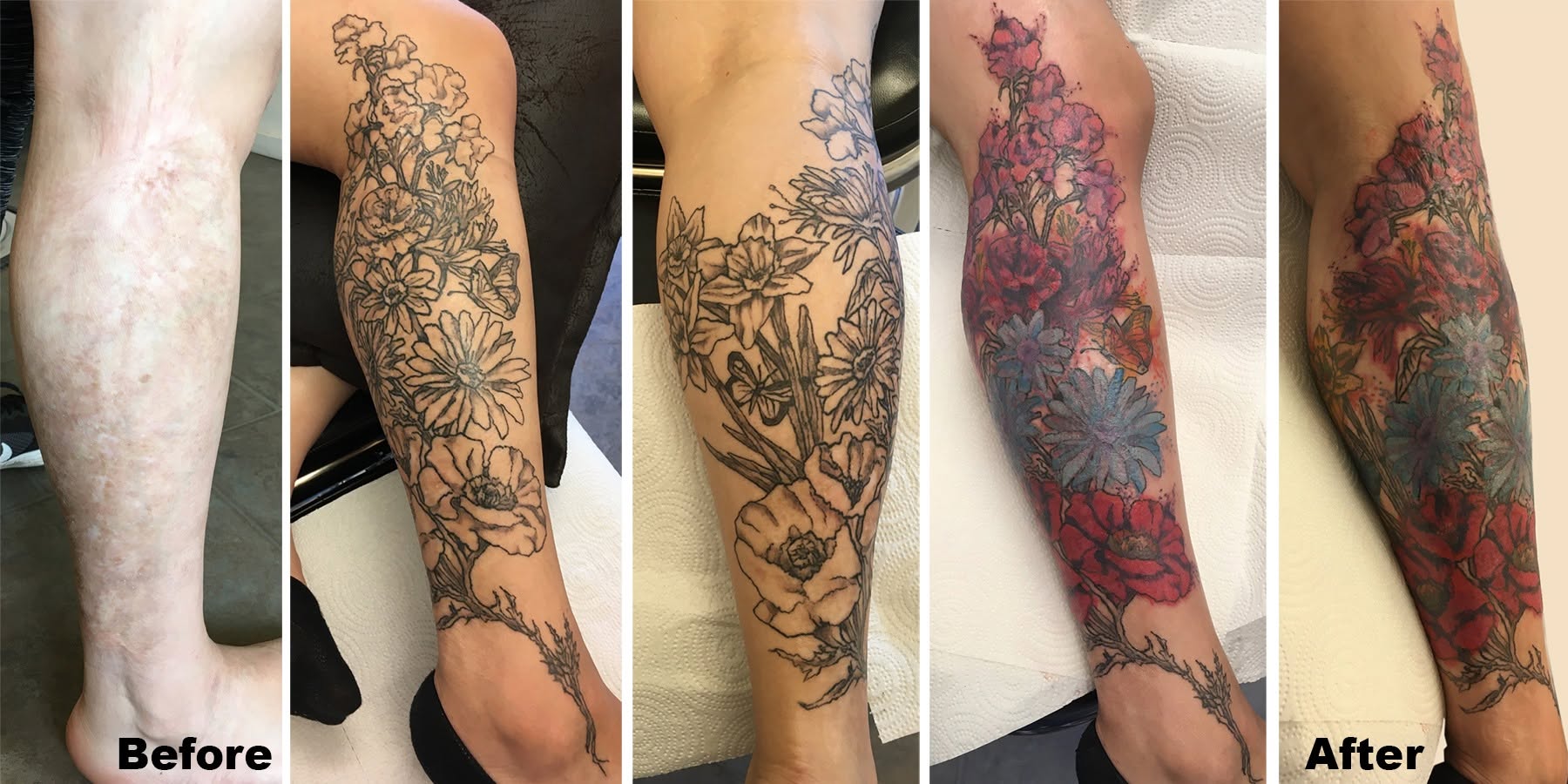 Sequence showing a leg tattoo before and after removal, with detailed floral and nature designs, and skin healing progress.