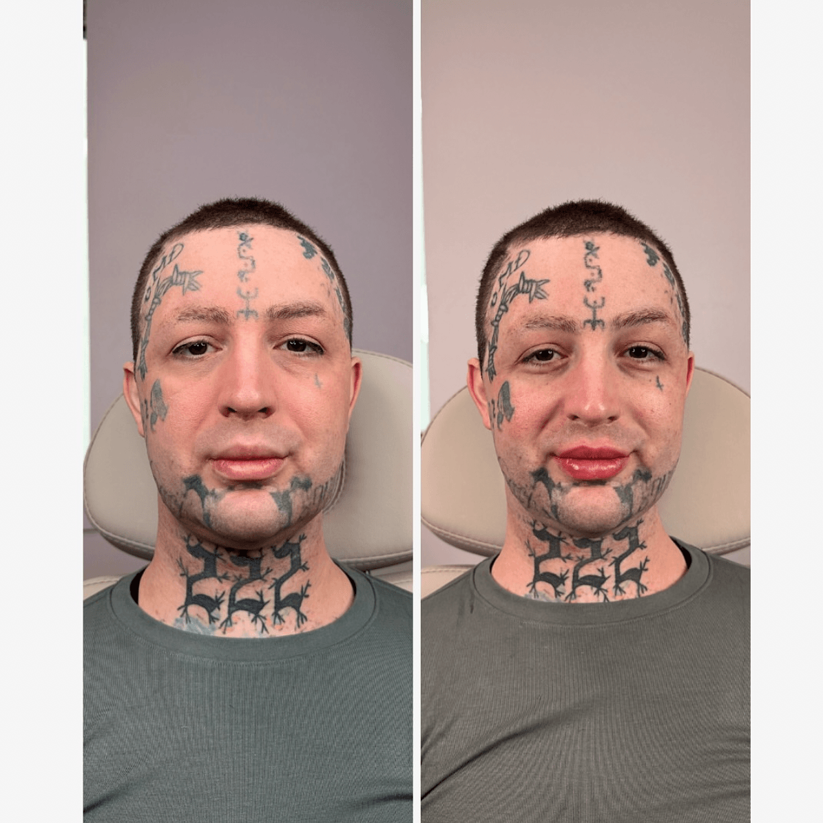 Side-by-side photos of a person with tattoos, one with a neutral expression, the other smiling, wearing a gray shirt.