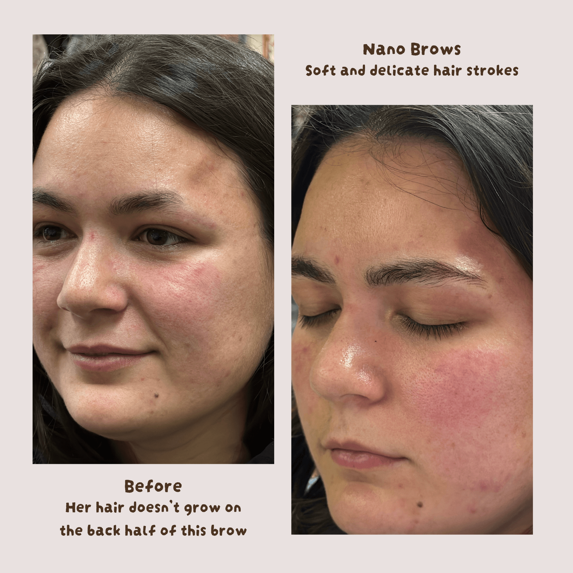 Comparison of eyebrows before and after treatment, showing improved hair growth and hair strokes, with the person having closed eyes in the after image.