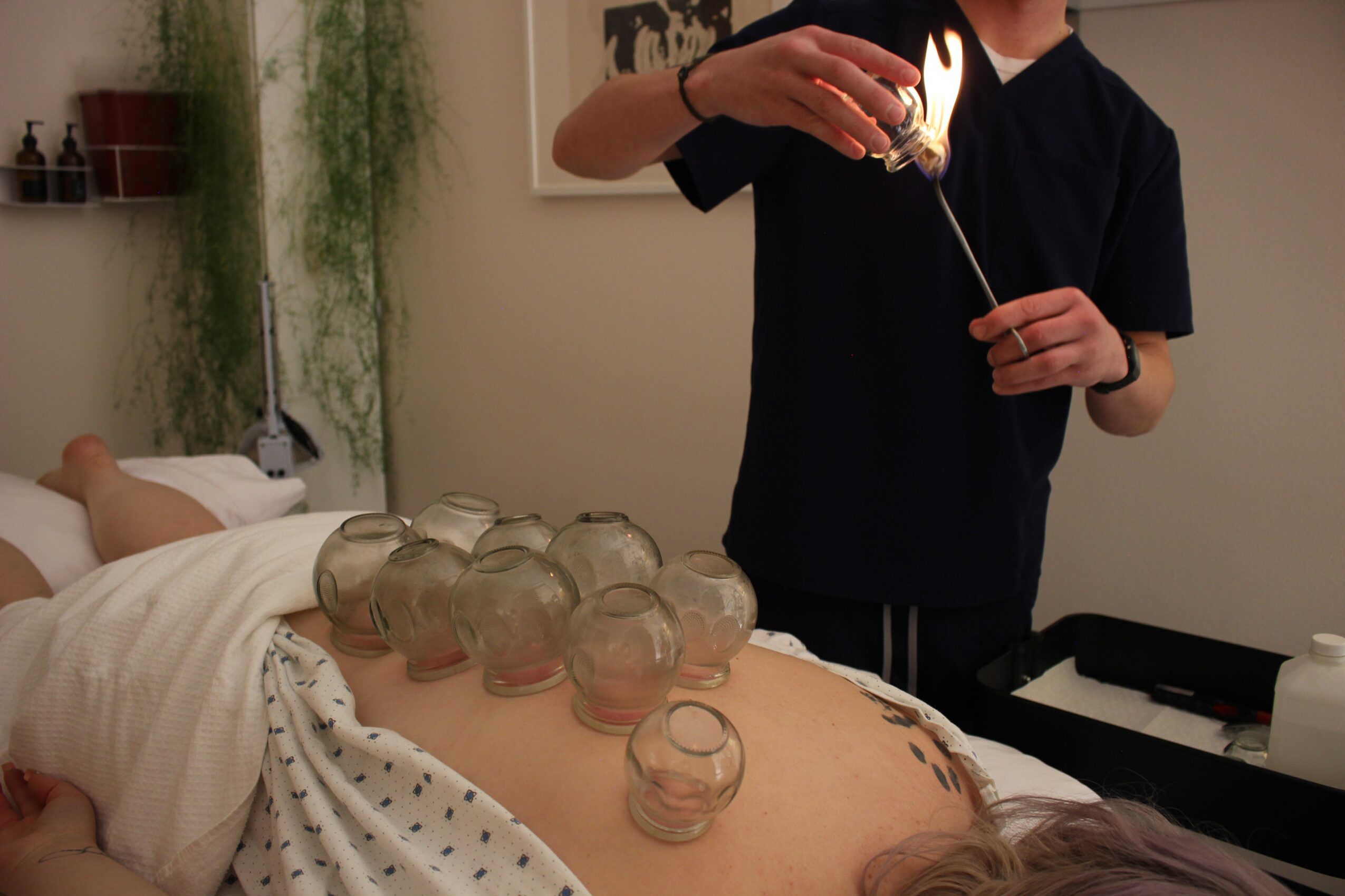 Person lying on bed with multiple glass jars on their abdomen, another person standing nearby holding a glass dropper, in a room with plants and artwork.