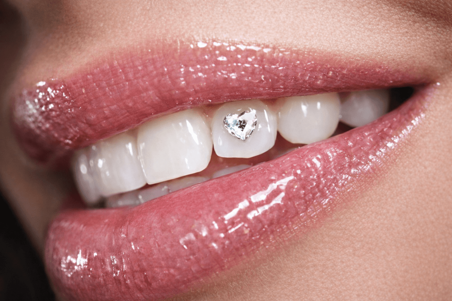 Close-up of a person's smile showing teeth with a small heart-shaped decoration on one tooth, lips glossy and slightly parted.