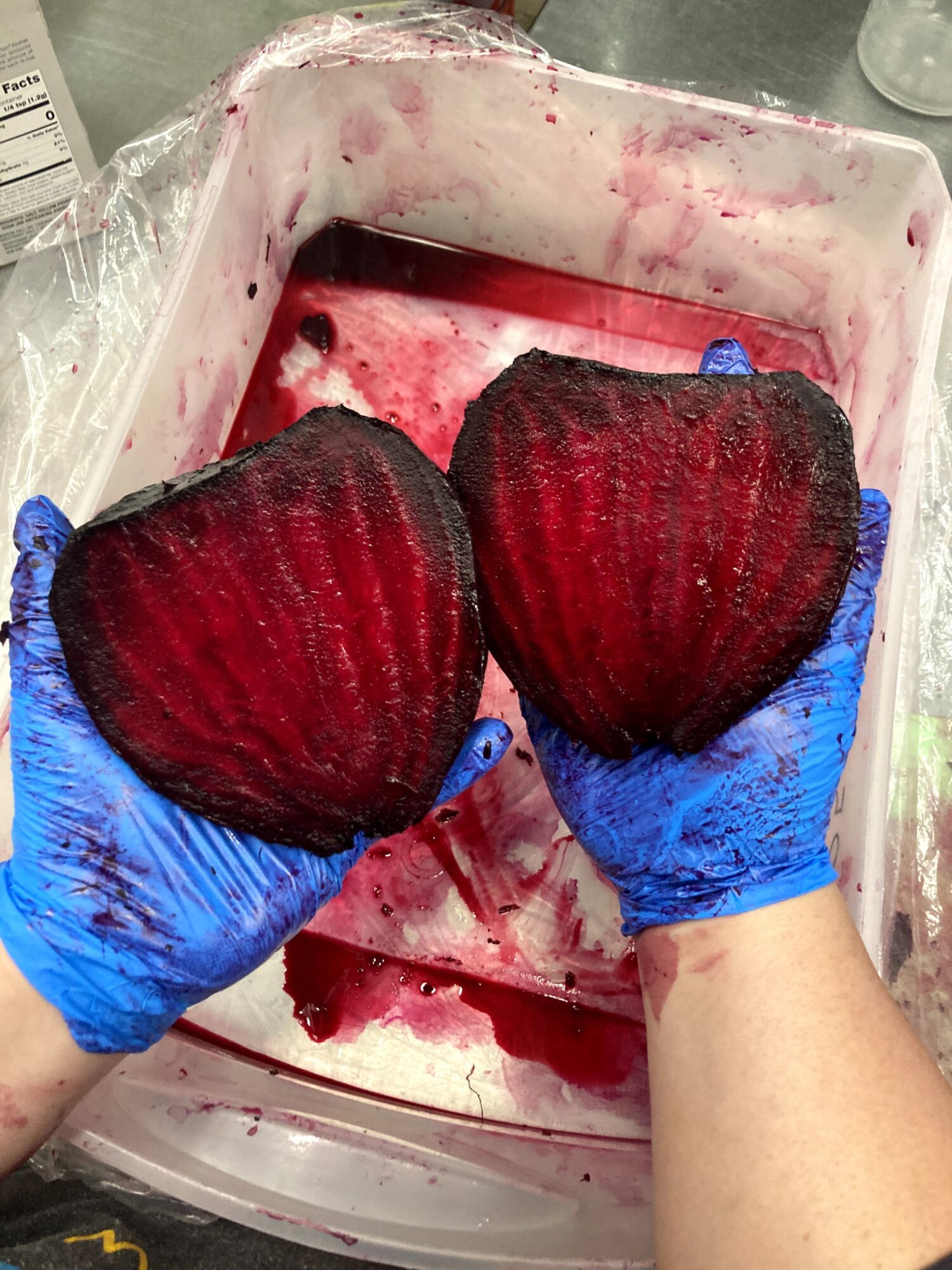 Person wearing blue gloves holding two large, dark red, heart-shaped tissue samples over a blood-stained container.